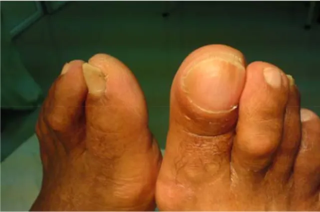 Fig. 1. Aspecto externo 