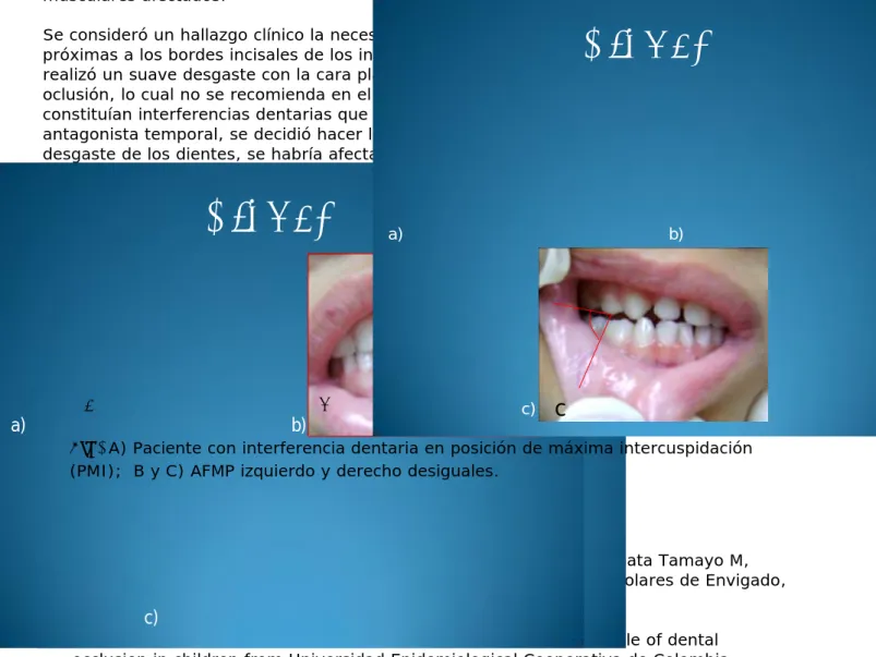 Fig. A) Paciente con interferencia dentaria en posición de máxima intercuspidación 