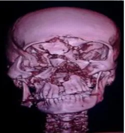 Fig. 1.  TAC multicorte con reconstrucción tridimensional 