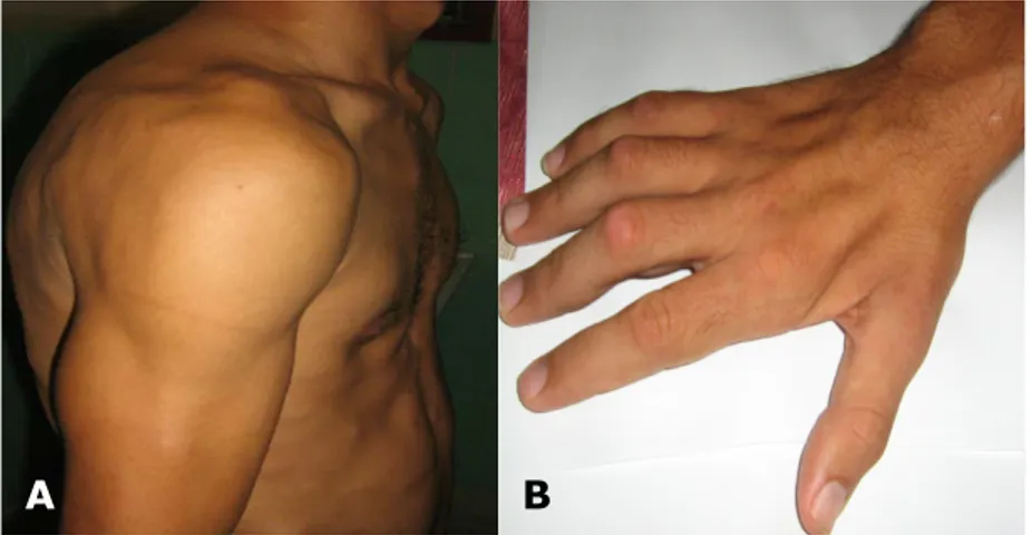 Fig. 3. Resonancia magnética de columna cervical, sagital, en T1 y T2 