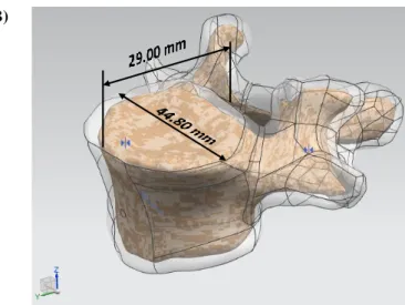 Figura 4. Reconstrucción del sólido CAD. A) Subdivisión del modelo geométrico, en color azul, en superficies de 3 y 4 bordes; B) Ensamble de los  modelos sólidos CAD con las dimensiones de la cara superior del cuerpo vertebral cortical.