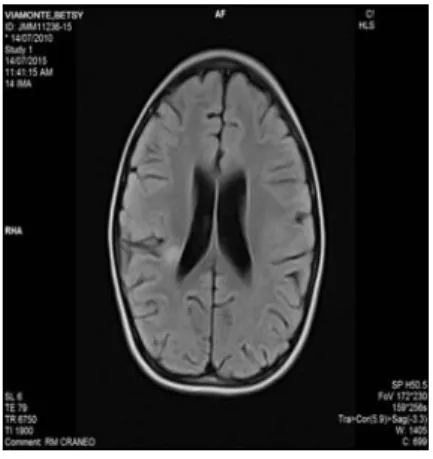 Fig. 4. Imagen IRM derecha 6 meses después normal 