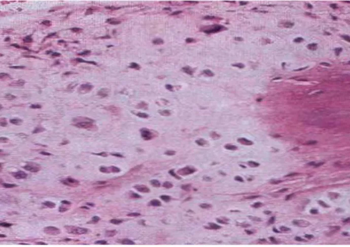 Fig. 3. Aspecto microscópico de la lesión. 