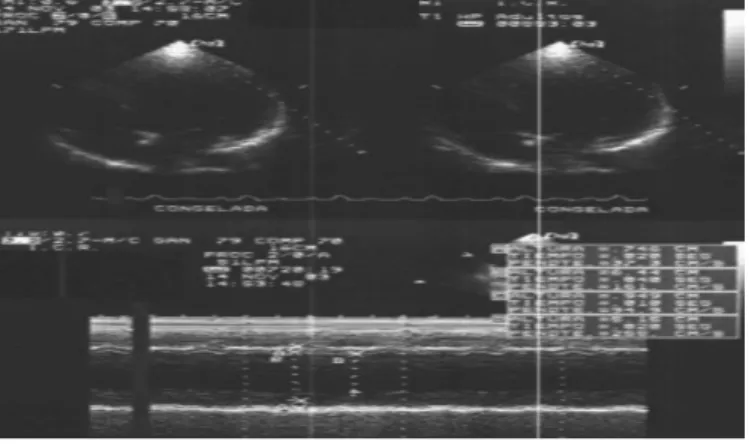 Fig. 2. Ecocardiograma. 