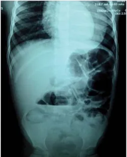 Figura 1. Radiografía de abdomen en decúbito.