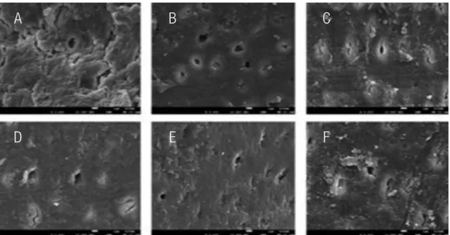 Figure 4. Representative scanning electron micrographs of experimental dentin posts’ surfaces