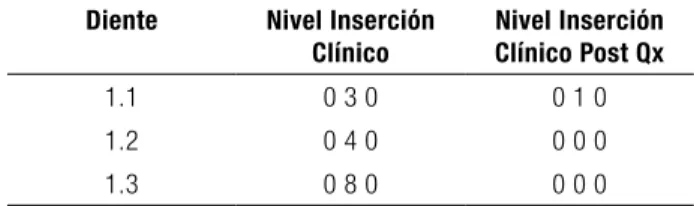 Tabla 1. Profundidad de sondaje y Niveles de 