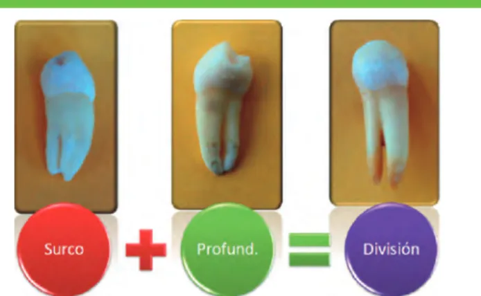 Figura 1.  Análisis anatómico radicular de los premolares extraídos.