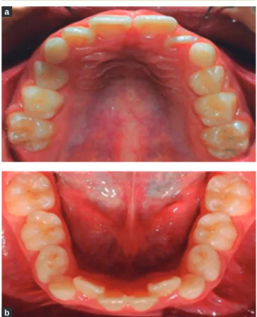 Figura 4. A. Lateral derecha y B. Lateral izquierda.