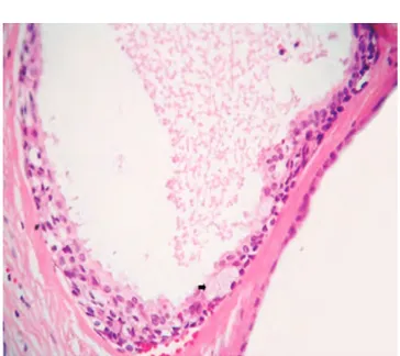 Figura 10. Histopatológía compatible con granuloma periapical.Figura 9. Reparación de la zona periapical, a cuatro semanas del tratamiento.