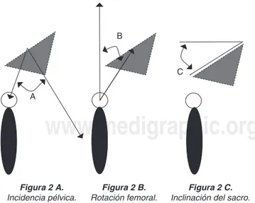 Figura 2 A.   Incidencia pélvica.