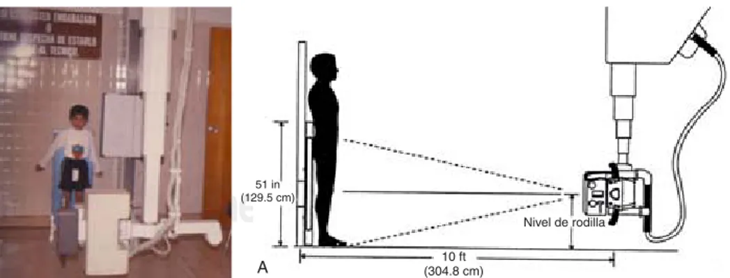 Figura 4. Técnica radiológica para la obtención de radiografías en películas largas.