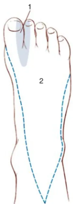 Figura 5. 1) Zona de anestesia 