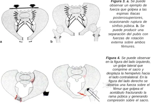Figura 3. a. Se puede