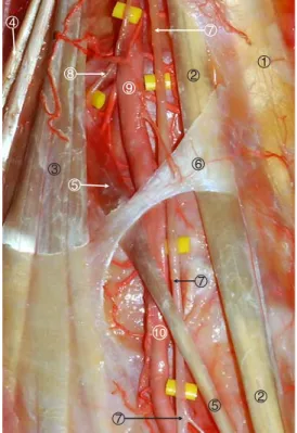Figura 7. Detalle Fig. 6. 1. Tendón del músculo tibial anterior. 2. Tendón del músculo extensor largo del dedo gordo