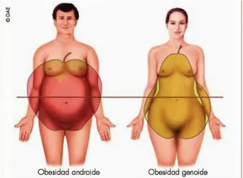 Gráfico 2: Tipos de Obesidad  Fuente: Lic.Nut. Gisela Pineda  