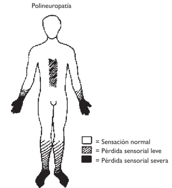 Figura 4. La pérdida de la sen-