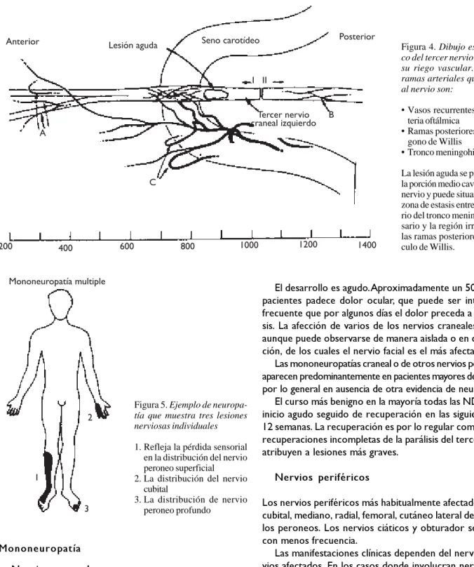Figura 4. Dibujo esquemáti-