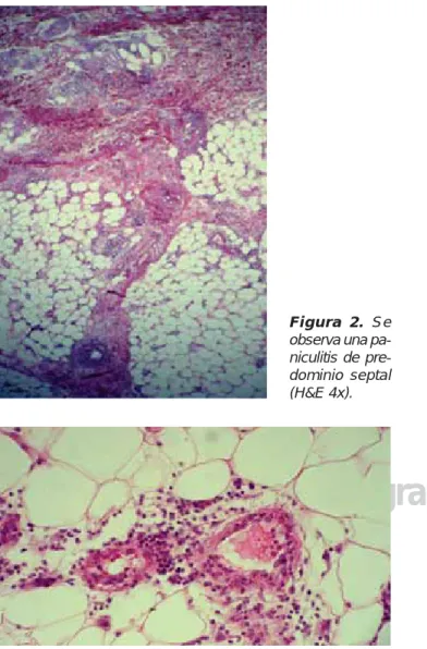 Figura 2. Se 