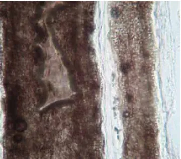 Figura 7. Parasitación del pelo de tipo endotrix.Figura 5. Acentuación de pliegues, eritema y escama discreta.