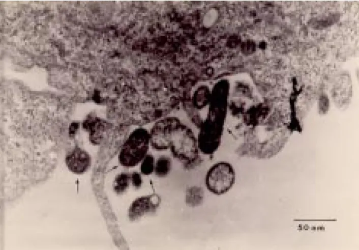 Figura 2.- Micrografía electrónica de transmisión que
