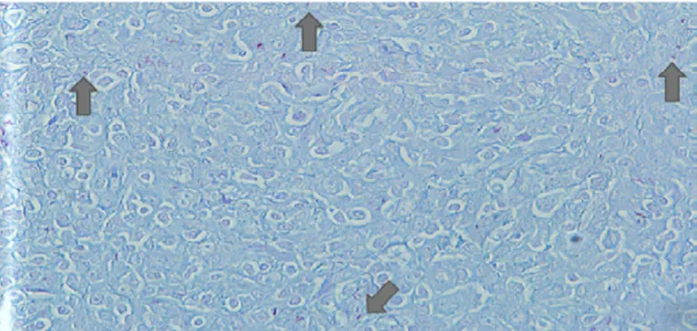 Figura 2. Bacilo de Mycobacterium tuberculosis en tinción de 