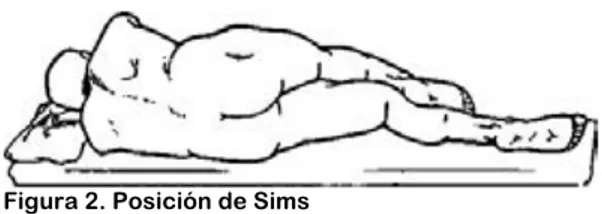 Figura 1. A. antiguo espéculo rectal griego y ro- ro-mano, B. del libro Sharaf ed Din-anorectal examine,  C