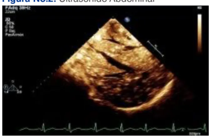 Figura No.2:  Ultrasonido Abdominal 