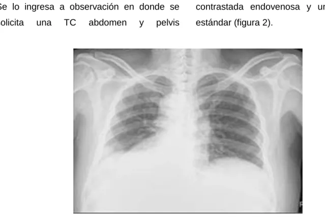 Figura  2.  Radiografía  standard  de  tórax. 