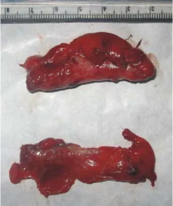 Fig. 1. Piezas quirúrgicas. 
