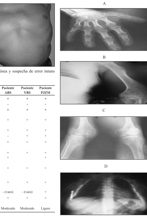 Figura  2.  Paciente  YBS.  Obsérvese  el  tronco 