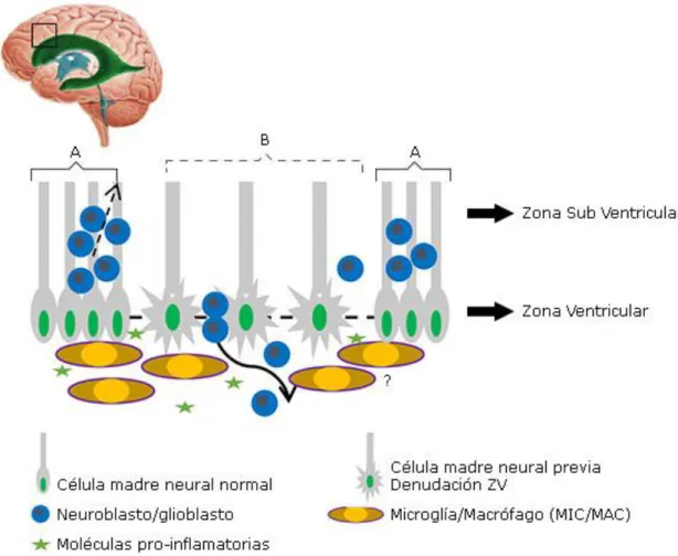 Fig. Representación del proceso desencadenante de problemas neurogénicos 