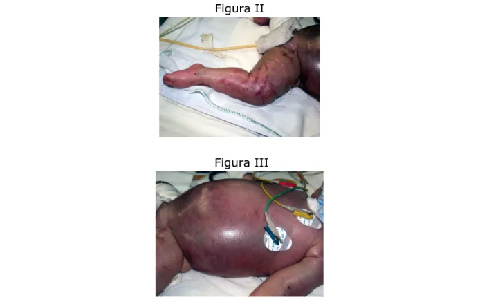 Figura II