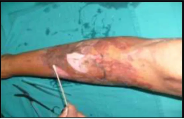 Fig. 1. Toma de muestra 