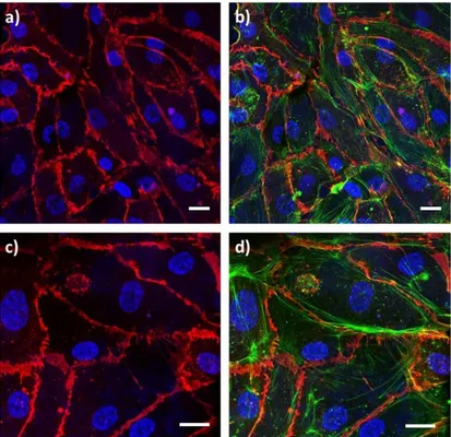 Figure 4. Endothelial progenitor cell layer obtained after 1 day of culture. a) and c) Confocal  microscopy images showing CD31 staining (red) with DAPI as nuclear counterstain (blue); b)  and d) Confocal microscopy images showing CD31 (red) and phalloidin
