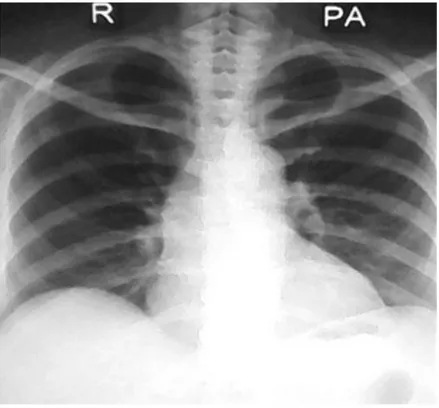 Fig. 3 - Aspecto radiológico después del tratamiento. 
