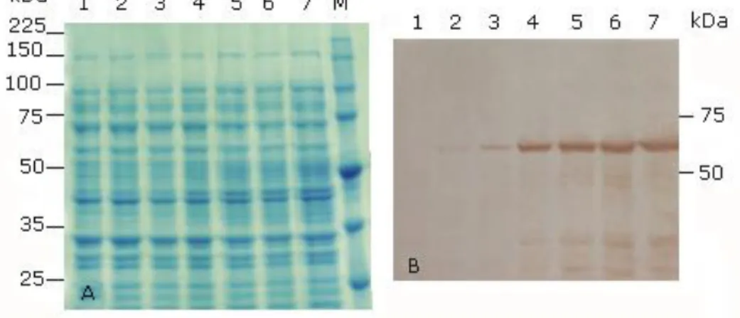 Fig 2 - Production of the full-length HPV-18 L1 at different time of induction and concentrations of 