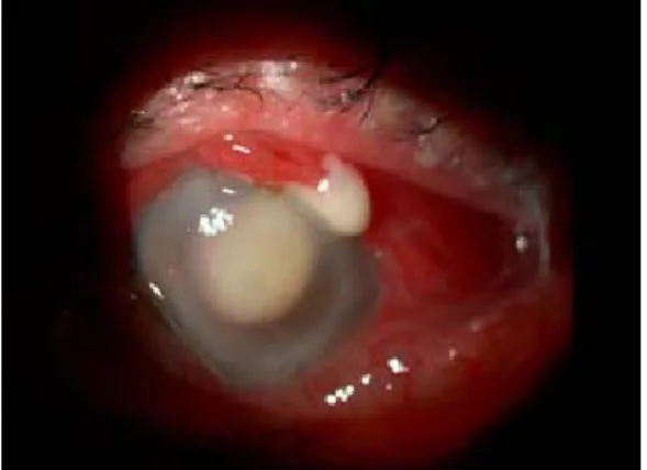 Fig. 1. Características del segmento anerior y diagnóstico. 