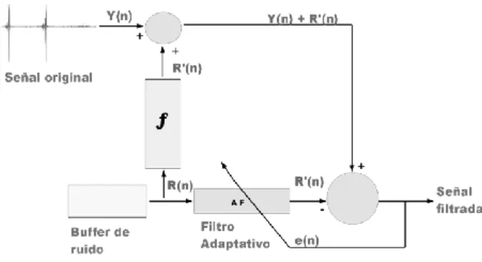 Figura 2: Proceso para adquirir la señal EMG. 