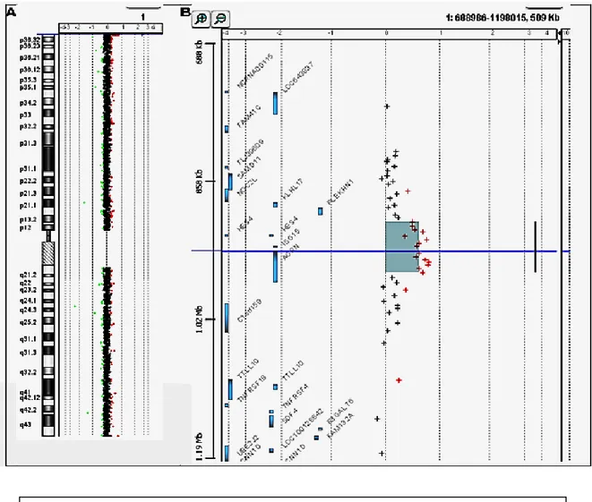 Figura 2. Resultado del aCGH de nuestro paciente en el que se encuentra una 