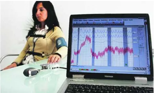 Figura 2.11: electromiografía 