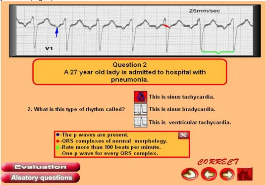 Fig. 2. Pantalla de lectura electro.