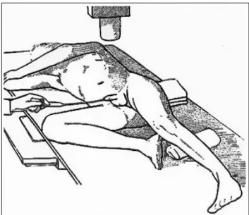 Fig. 4. Uretrocistografía, posición correcta. 