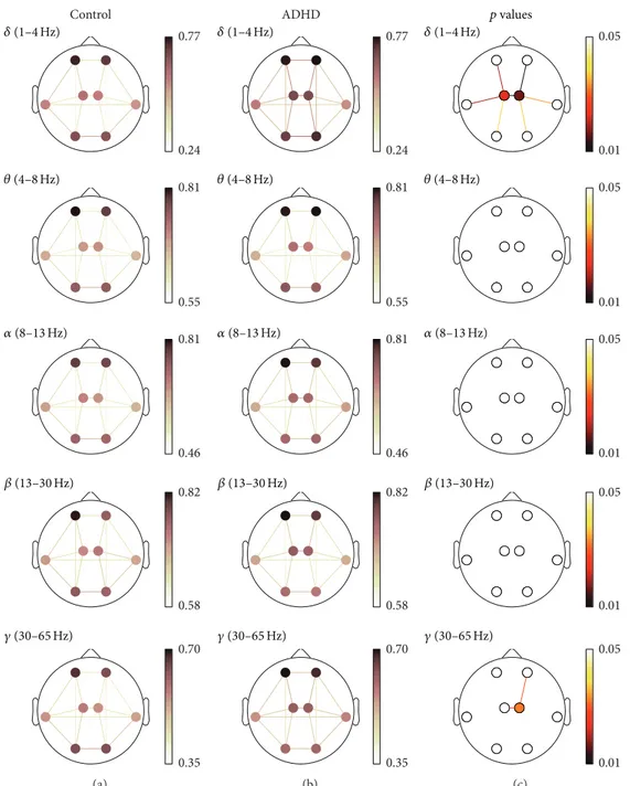 Figure 3: PLV spatial analyses. (a) and (b) depict PLV values for controls and ADHD patients, respectively