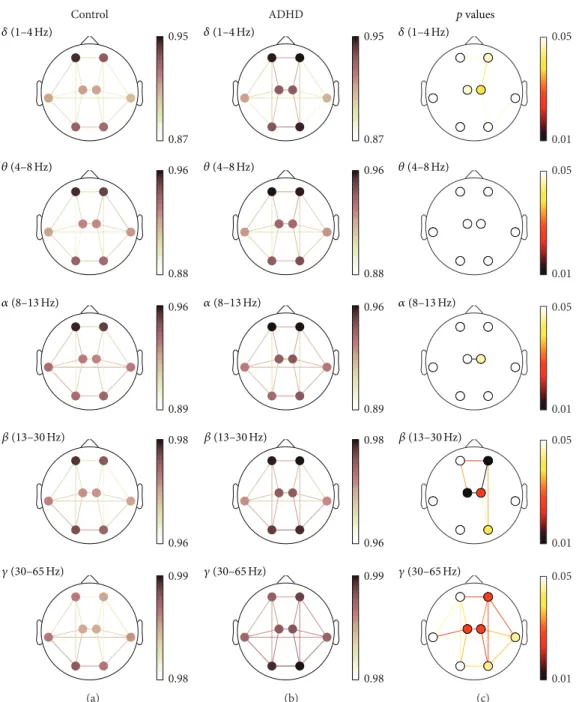 Figure 4: ED spatial analyses (ED). (a) and (b) depict ED values for controls and ADHD patients, respectively