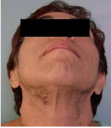 Figura 2.  TAC abdominal. 
