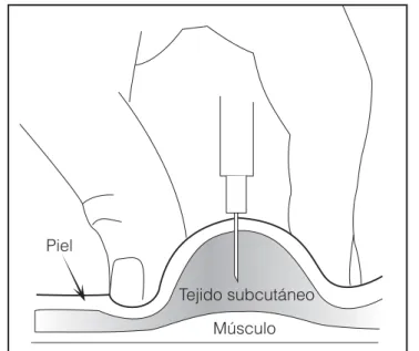 Figura   1.   Técnica   de   aplicación   subcutánea. Nótese la angu- angu-lación a 90 grados, así como la forma en que se repliega la piel.