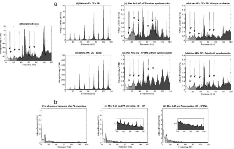 Fig. 2. Voltage density for Welch spectral estimation for: (a) PHANTOM DATA: (i) background noise, in the absence of pulse sequence; (ii) GE-EPI before applying AAS; (iii) GE-SPRLIO before applying AAS; (iv) GE-EPI without  synchronization after AAS; (v) G
