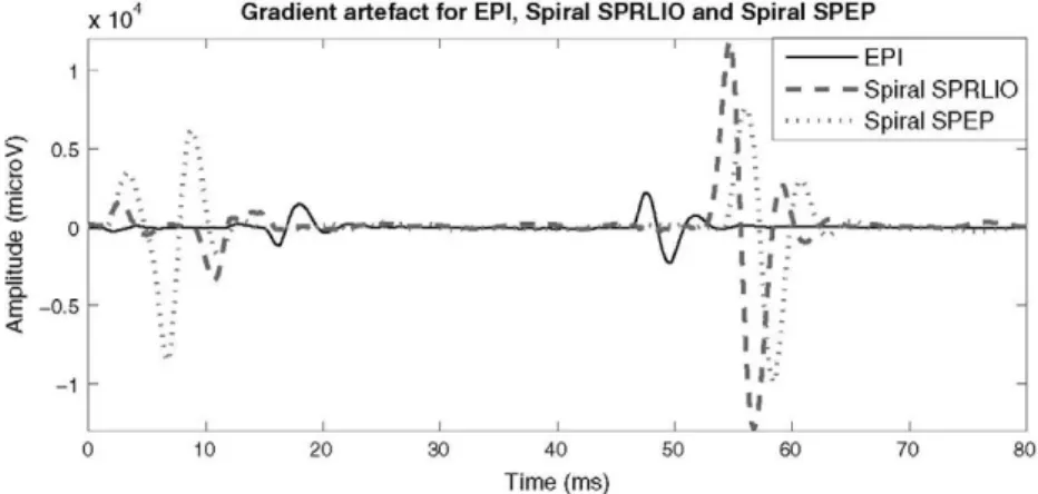 Fig. 6. Gradient artifact for two spiral fMRI pulse sequences (GE-SPRLIO and SPEP) and EPL 