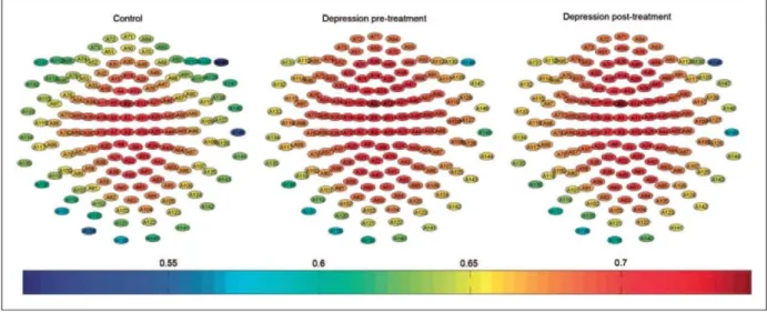 Figure 3. Average Lempel-Ziv Complexity (LZC) values in major depressive disorder (MDD) patients and control subjects for aLL channels, from Al to  A148, displayed in a colour scale